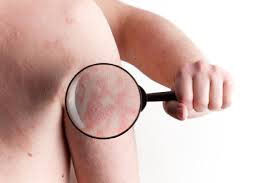 kliniki-dermatologia